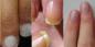 Kijk naar je nagels. 12 Deze afwijkingen kunnen veel over je gezondheid te vertellen