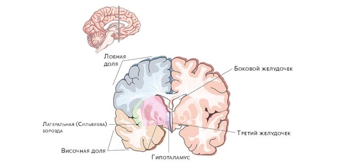 Hersenen ventrikels. De ophoping van vocht daarin leidt tot hydrocephalus.