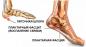 Fasciitis plantaris: de oorzaken en oefeningen om de voet te versterken