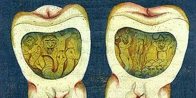 Middeleeuwse geneeskunde: een pagina uit de Ottomaanse tandheelkundige verhandeling, 17e eeuw.