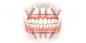Hoe kunt u uw tanden te herstellen en glimlach terug