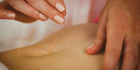 Acupunctuur: Wat is de moeite waard te weten over de behandeling van dunne naalden