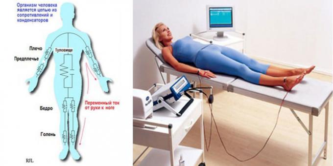 Body bio-impedantie analyse-apparaat "MEDASS"